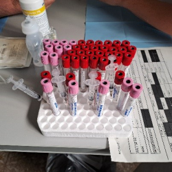 REAZIONI AGLI ANESTETICI LOCALI - PARTE PRIMA